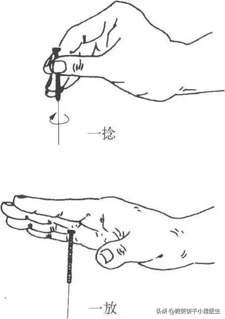 针灸无痛行针方法,无痛针灸