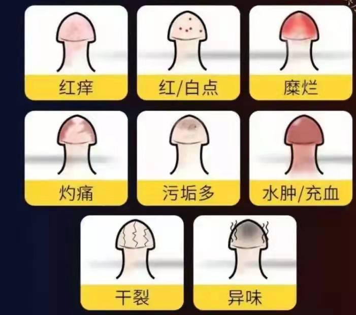 “丁头”发“炎”怎么办？—氦氖激光照射治疗为您排忧解“男”