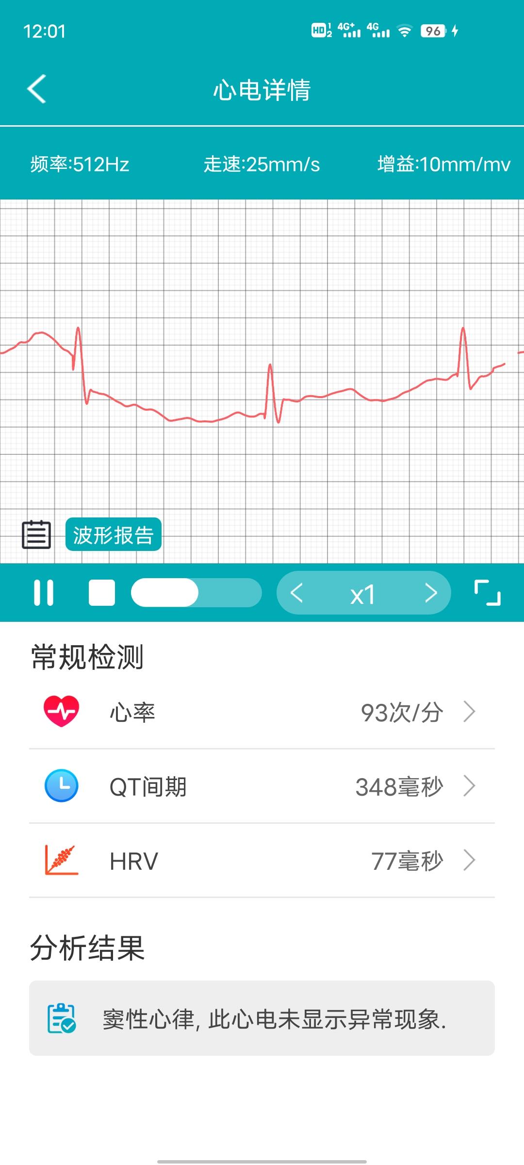手环健康监测哪款比较好,dido智能手环f50s和r40s区别