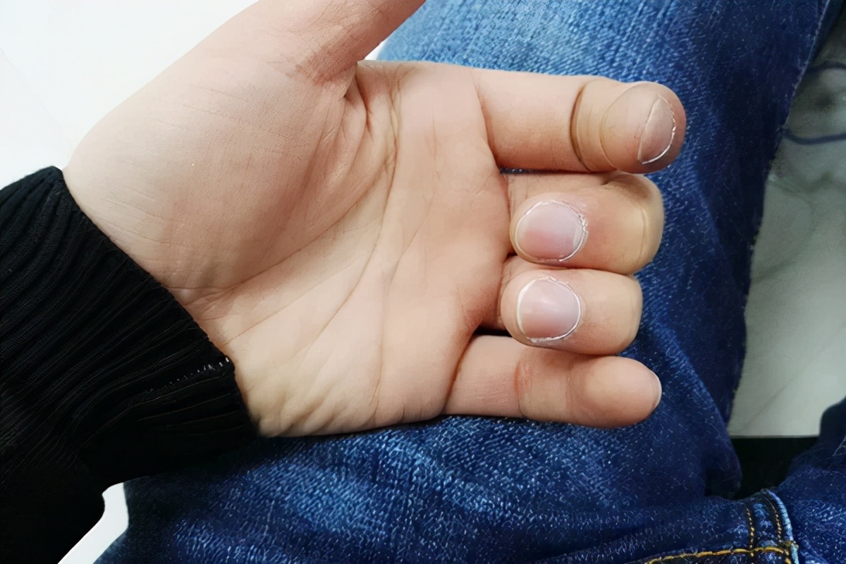 背痛和肺癌的早期症状及表现,背痛和肺癌