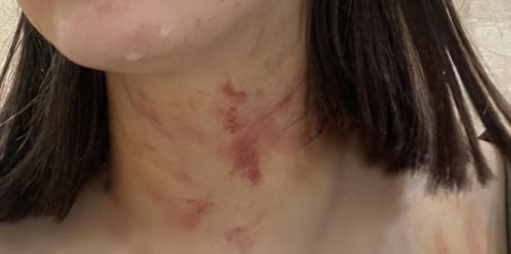 自述牵狗进电梯被邻居殴打女生道歉：账号设私密，主页发致歉文本