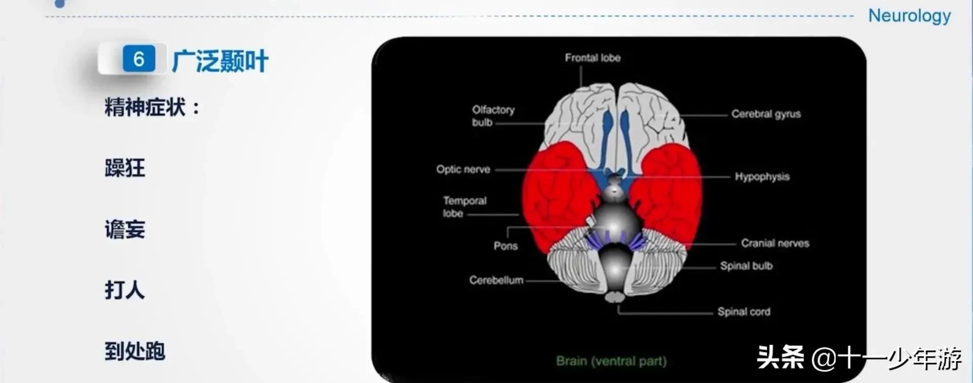 大脑的结构解剖示意图,大脑镰下疝解剖结构