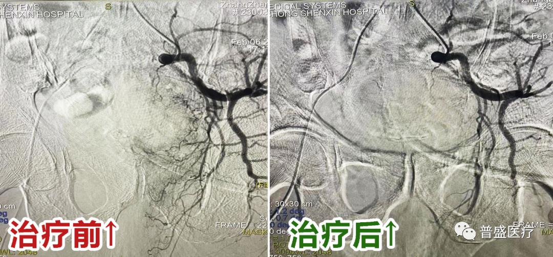南充治肿瘤最好的医院,南充哪家医院治肿瘤好
