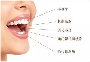 口臭是胃癌的症状吗,正常口臭与胃癌口臭的区别