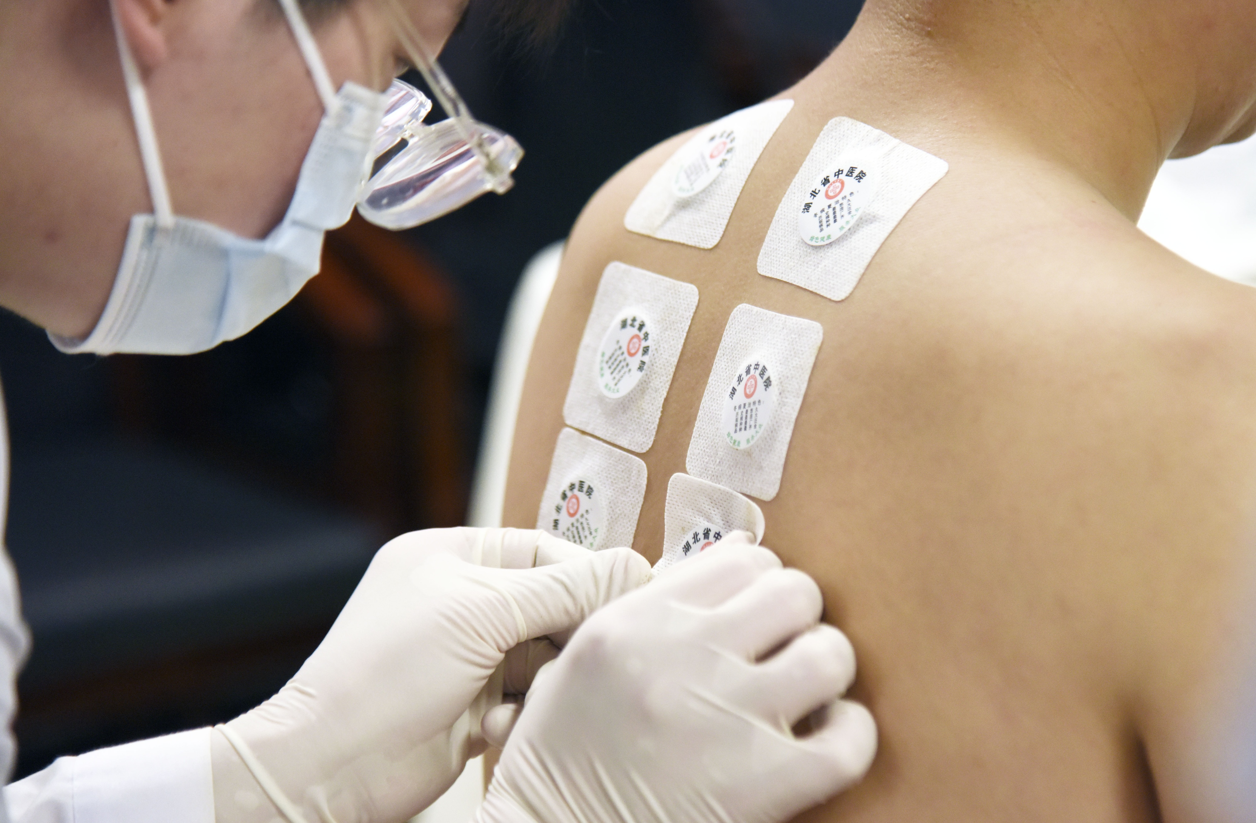 冬病夏治火爆进行中,冬病夏治三伏灸正在火热进行中