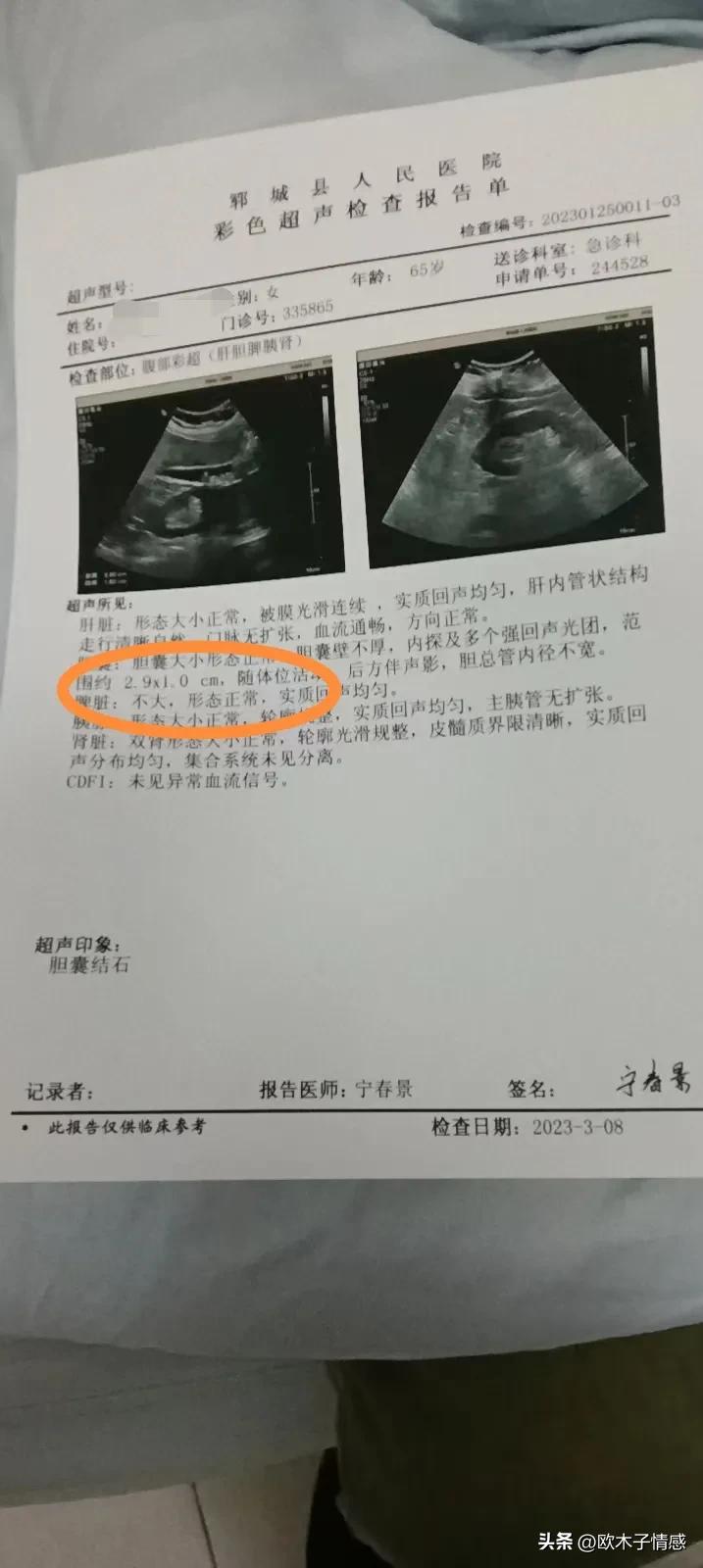 老年人切除胆囊危害,老年人胆结石有必要手术吗