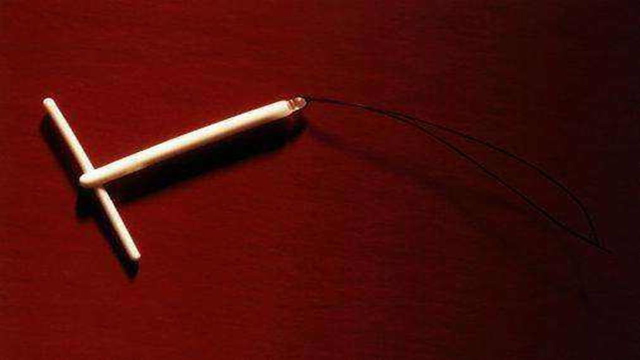 中国第一批“上环”的女性，医生直言：30年了，难逃出这4种结局