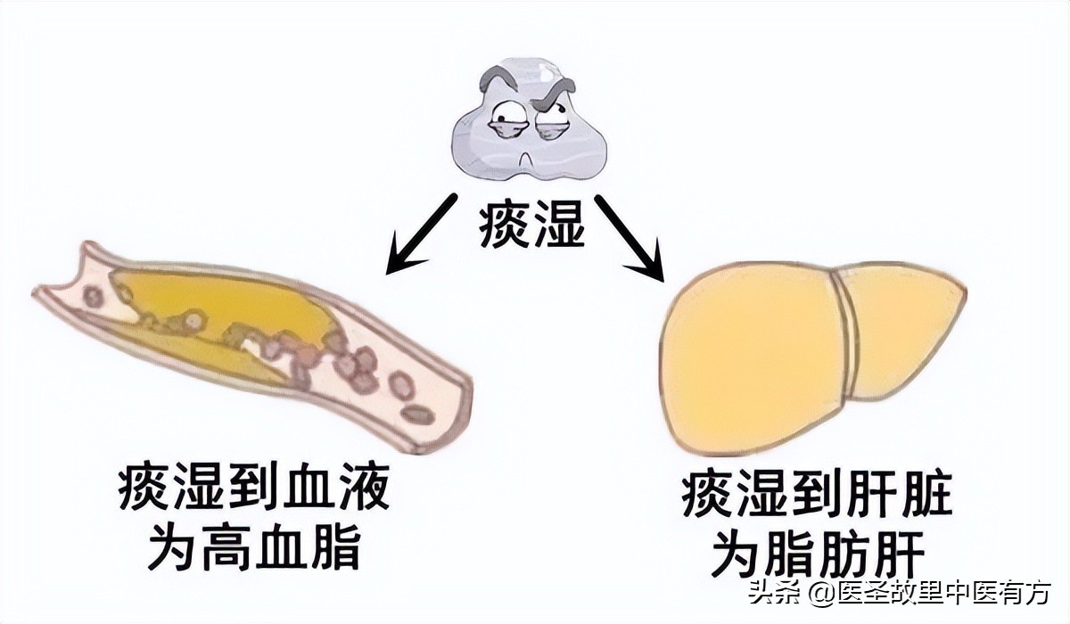 痰湿三味中药克星,治疗痰湿结节包块的一张秘方