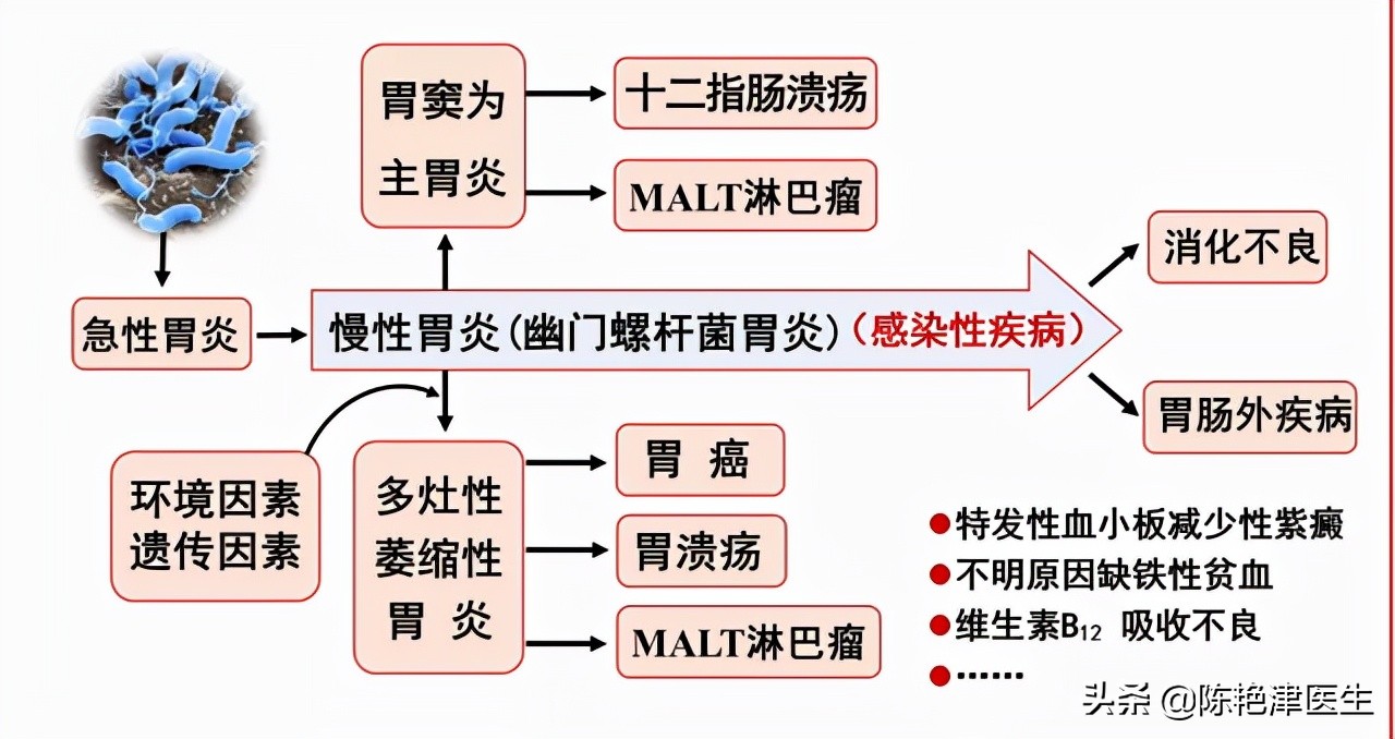 胃癌最大的祸根是幽门螺杆菌，想要彻底杀菌，记住3个办法