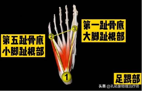 中老年人脚底痛是什么原因,老人脚底板好疼是什么原因