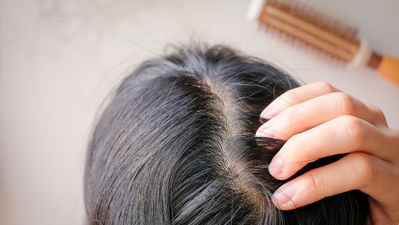 白发不可怕重要的是要选对方法,白发要吃什么才会转黑