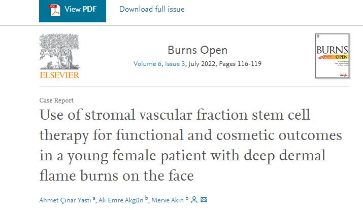 重度烧伤80%皮肤修复,皮肤烧伤的女孩后续