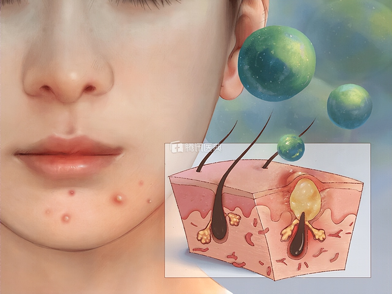 老化的皮肤可以做果酸换肤吗,果酸换肤后角质剥脱可以洗掉吗