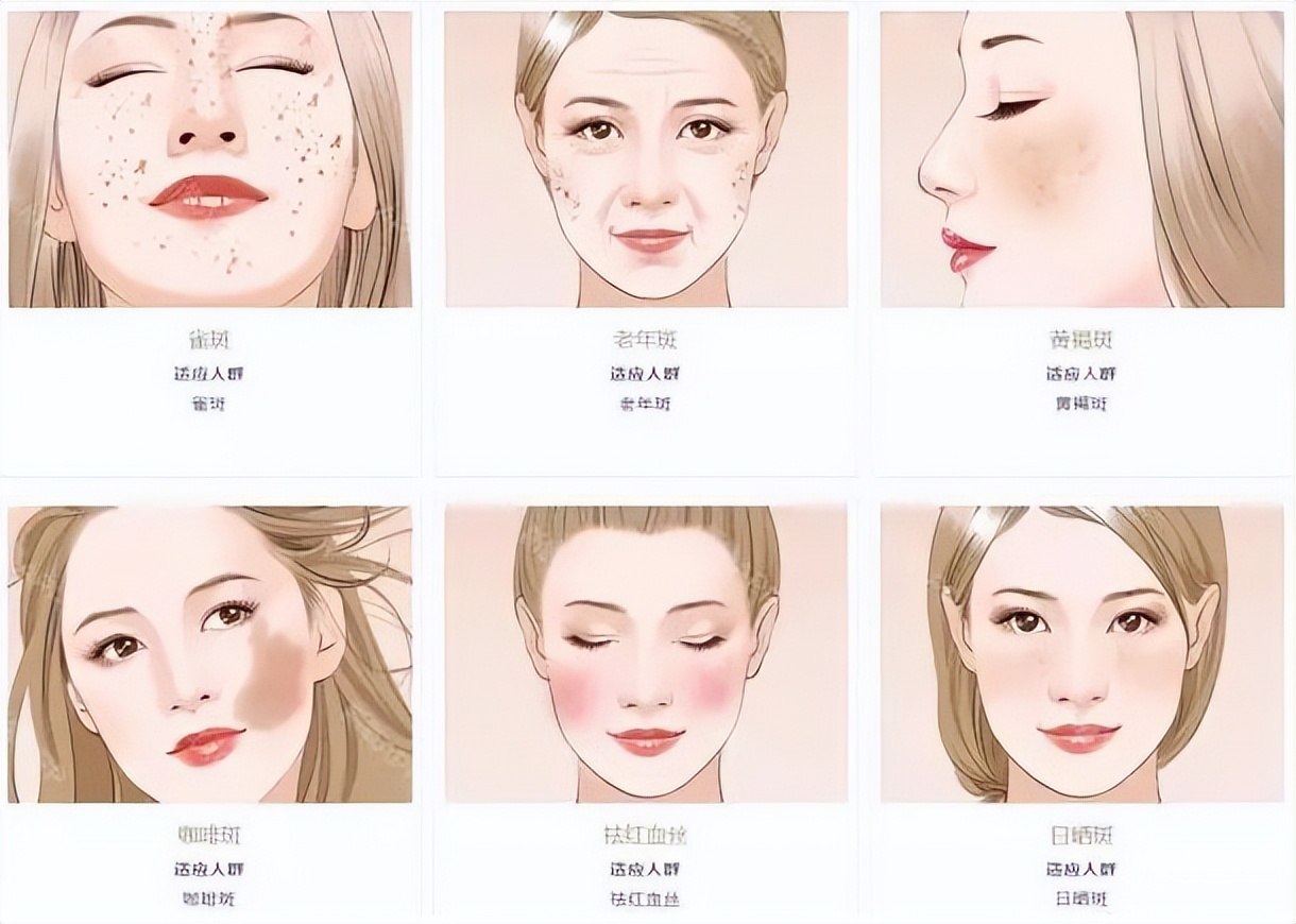 微针祛斑用什么药导入,涂抹式祛斑祛痣