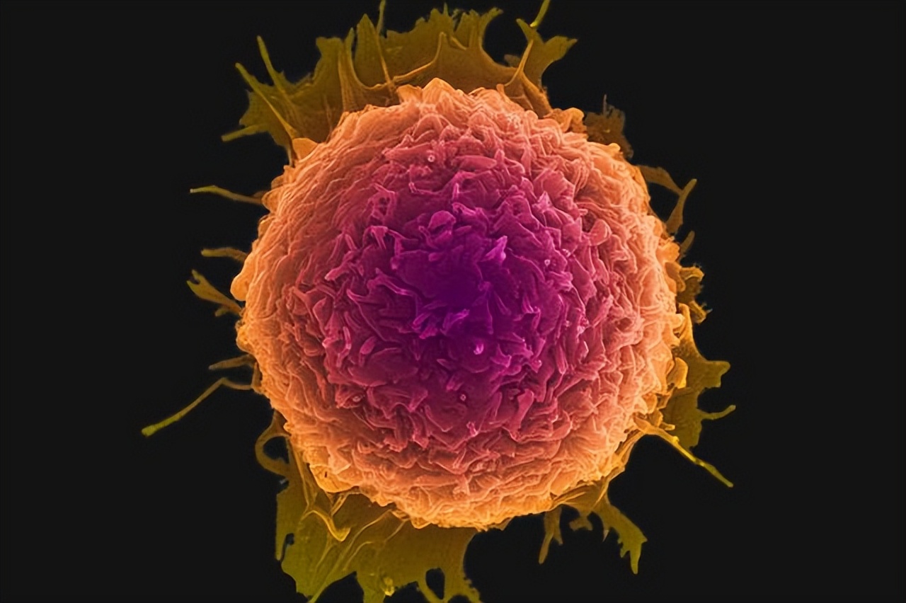 明明手术已经把肿瘤切除了，为什么还会复发？做好3件事或可预防