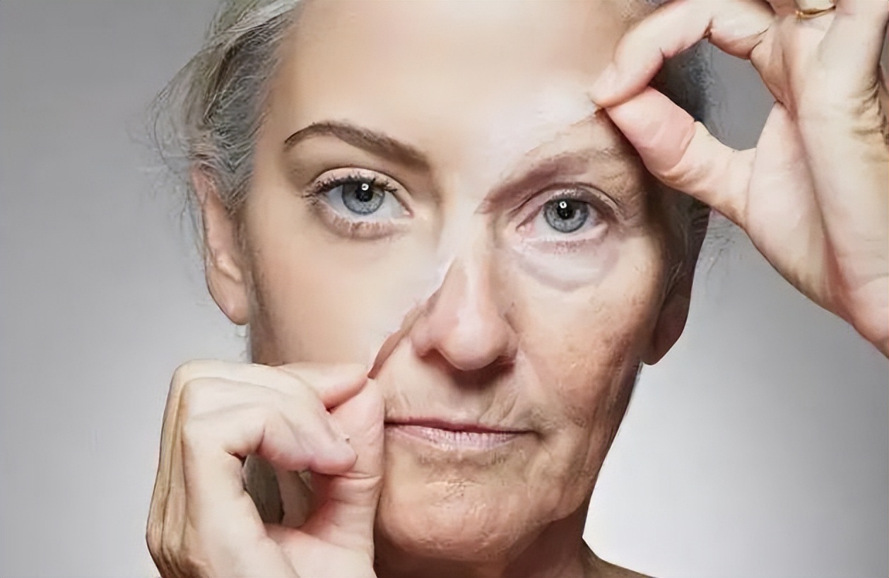 猕猴桃能消除脸上的皱纹吗,吃猕猴桃可以防止皱纹吗