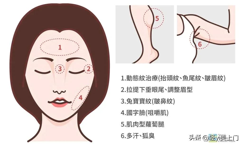 微整医美材料,医美微整注射图