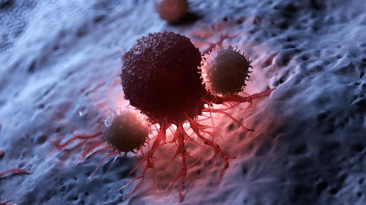 为何阴道炎越来越高发？提醒女性朋友：这6个错误习惯，尽早避开