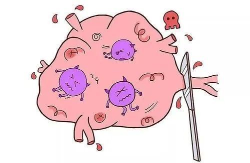 肝脏低密度灶需要进一步检查吗,肝脏稍低密度灶是肿瘤吗