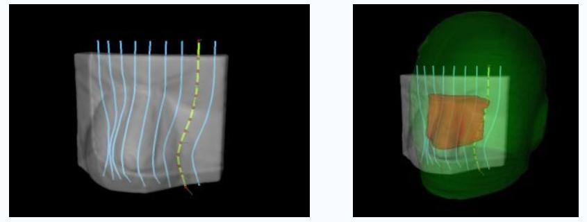 瓦里安单挑实力,瓦里安联合公司