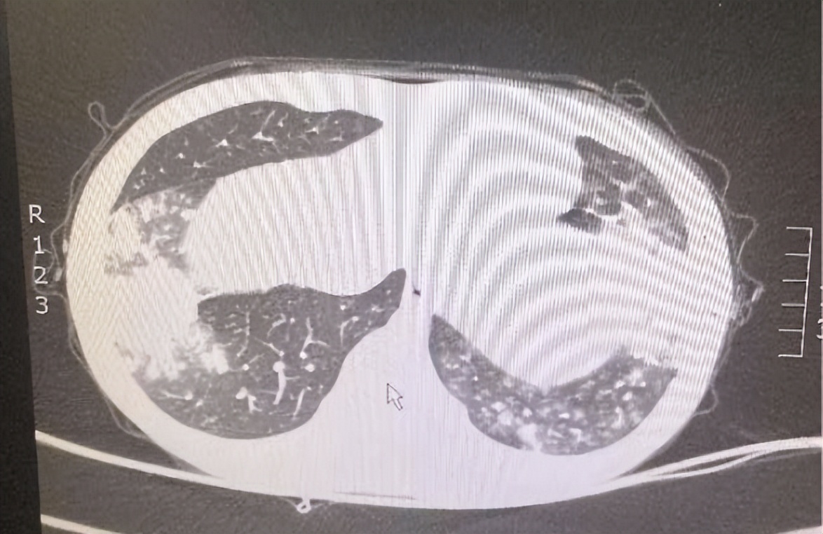 小孩咳嗽发烧前面高热后面低热,孩子反复高热咳嗽是什么原因
