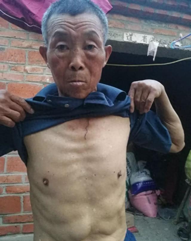 75岁老人犯强奸罪一审获刑3年,老人犯强奸5罪获刑三年