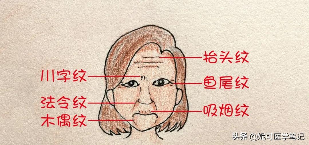 怎样淡化法令纹细纹,松垂型法令纹