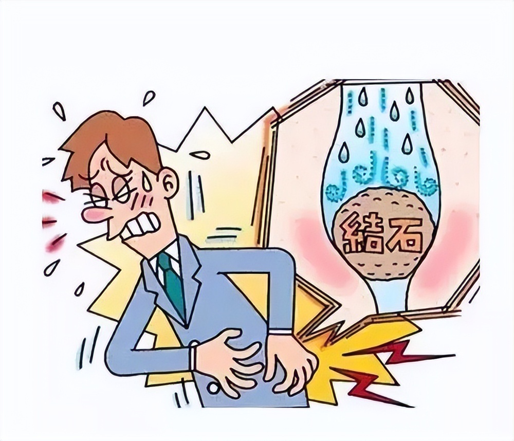 输尿管结石有什么明显的症状,输尿管结石主要症状问答库