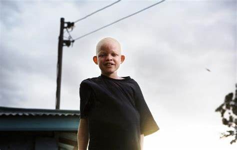 非洲版“唐僧”：血液堪比黄金遗骸可卖上百万，警方束手无策