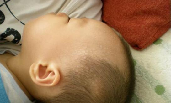 宝宝睡觉总是满头大汗怎么回事,宝宝睡觉老是满头大汗怎么回事