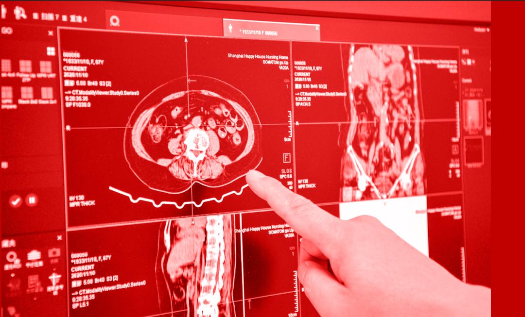 提升产业自主竞争力,天融信安全广域组网赋能大型医疗影像企业