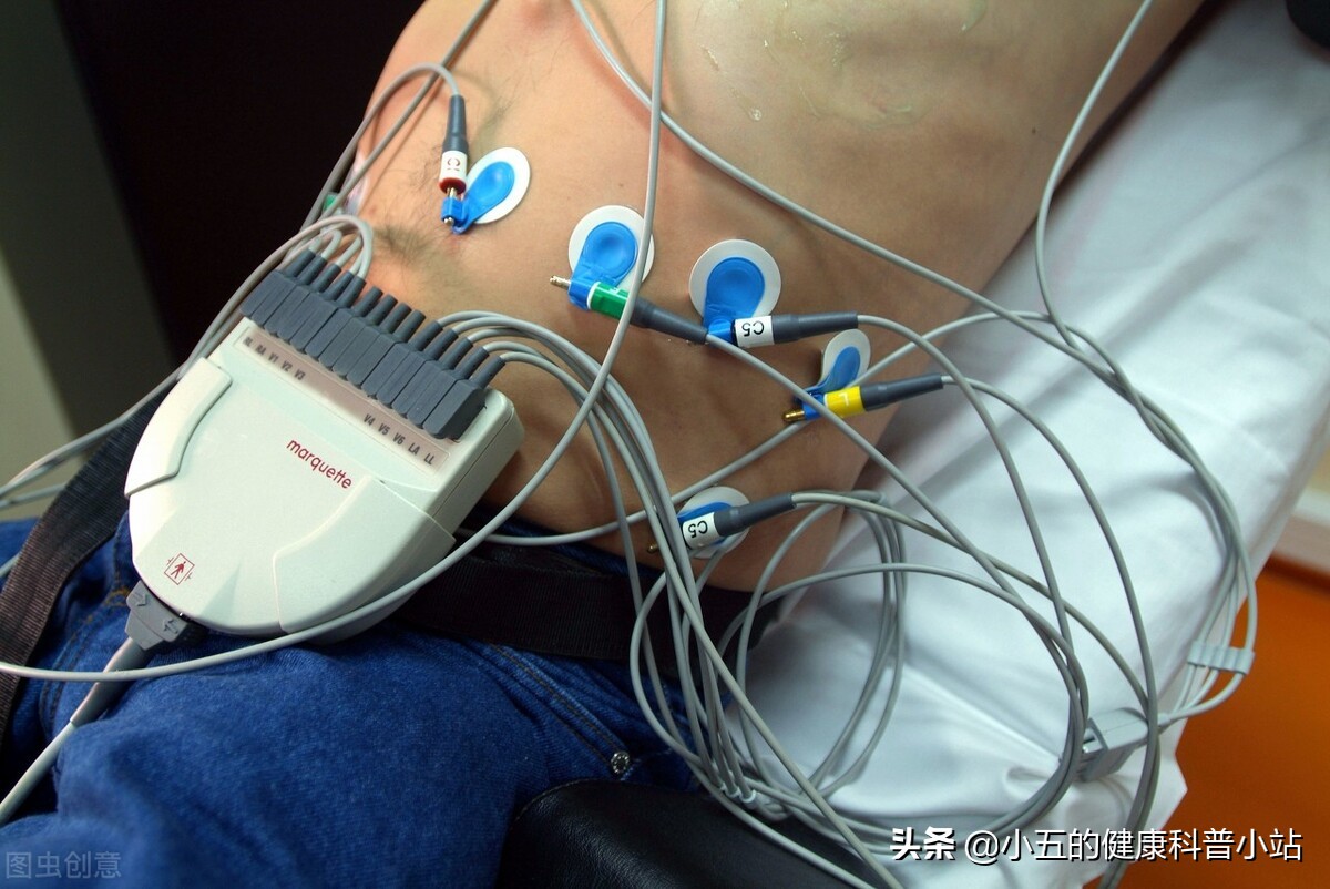 年轻人心房颤动治疗方法,老年人心房颤动用药