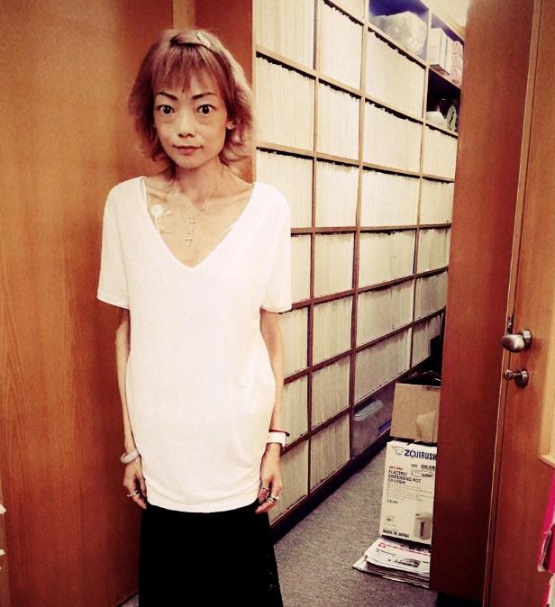 “最惨阔太”伍智恒：嫁豪门8年，换来牙齿全脱，体重仅剩44斤