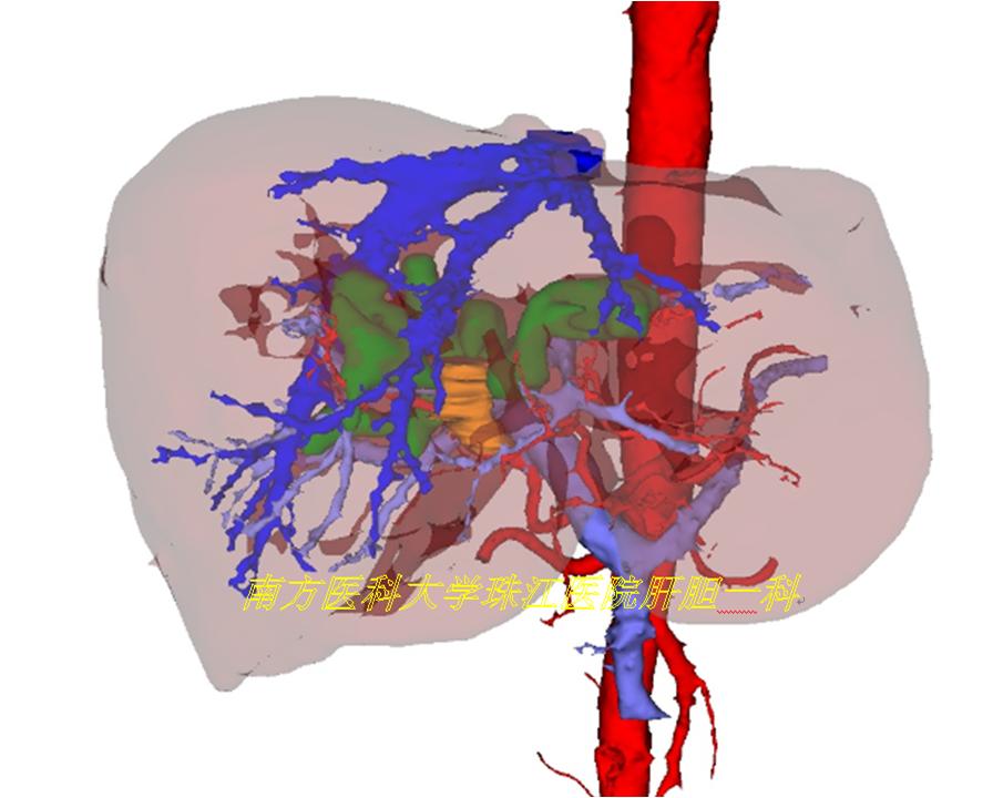 三维透视眼,透视眼治疗肿瘤
