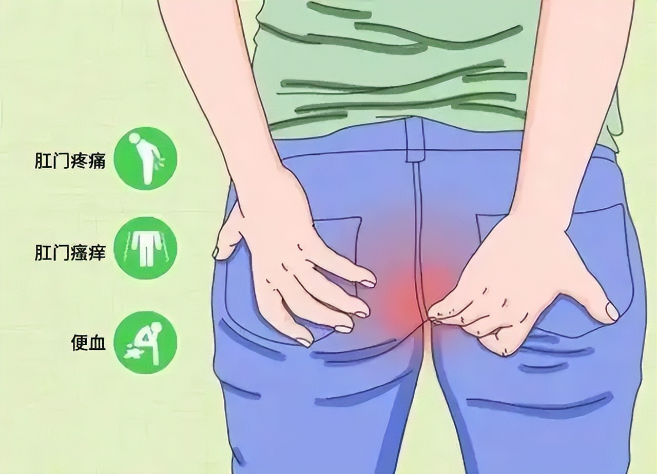 别说你会擦屁屁！43岁衢州大哥因这里没清理干净，住院了！