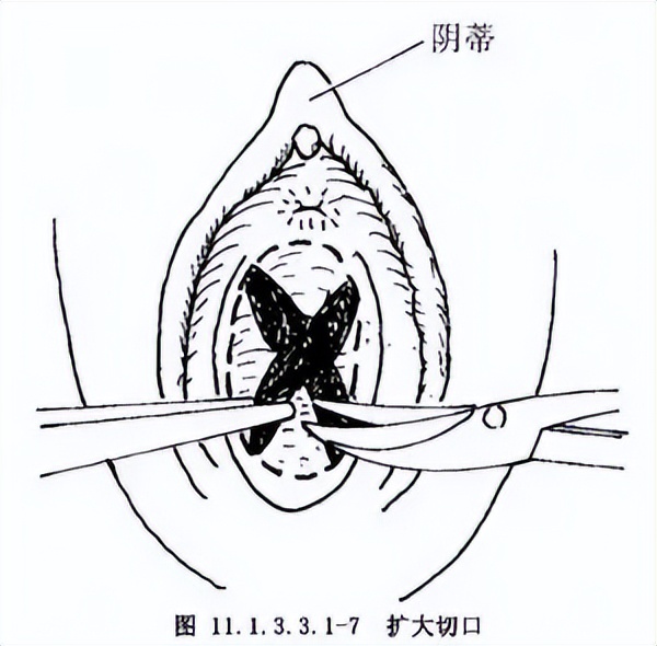 女孩11岁肚子疼肠痉挛怎么回事,13岁女孩肠痉挛应该怎么办