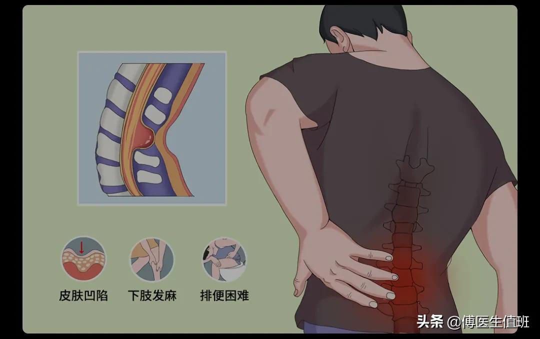 孩子6岁了老是尿床怎么办,男孩4岁尿床脊椎裂