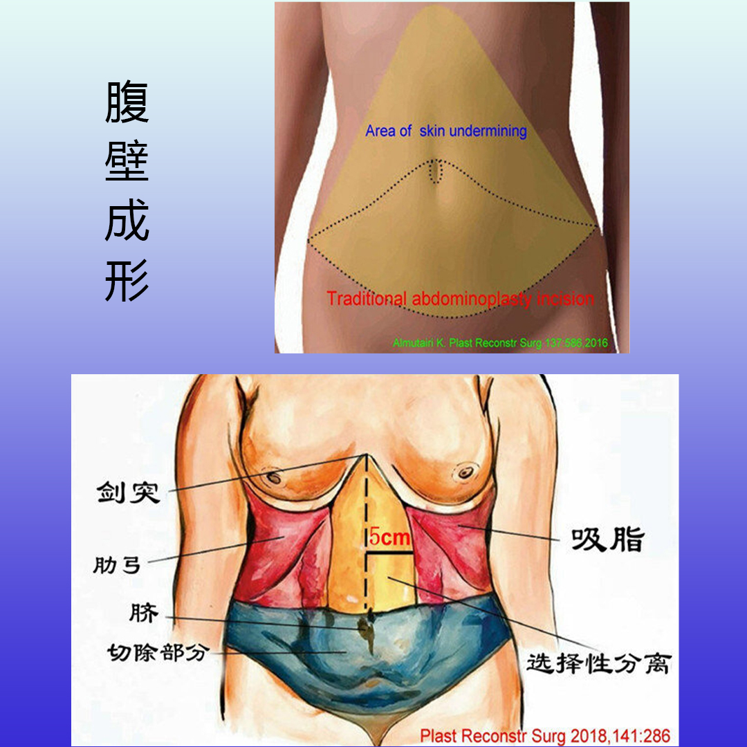 产后肚皮松松垮垮怎么练,产后肚皮松松垮垮怎么办啊