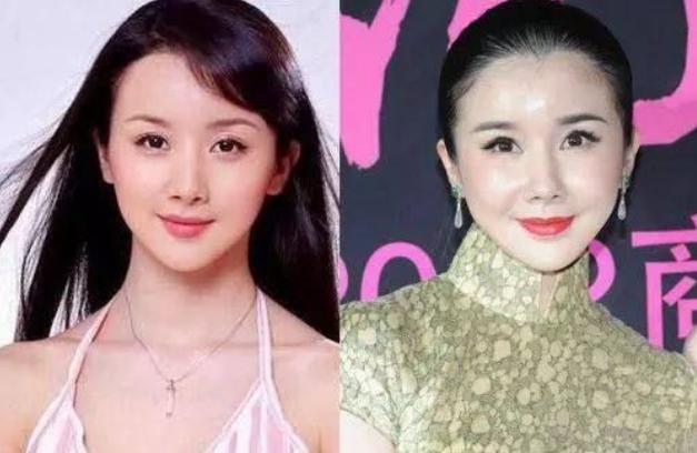 整容过度垮脸的女星,整容失败的蛇精脸女演员