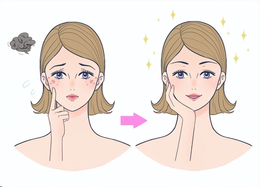 斑小将美白祛斑霜多久能看到效果,斑小将祛斑霜真的能祛斑吗