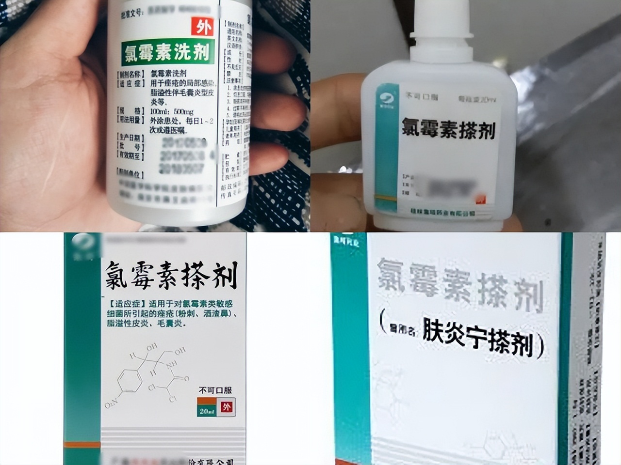 药店常卖的抗病毒感冒药有哪些,抗细菌感染的药品有哪些