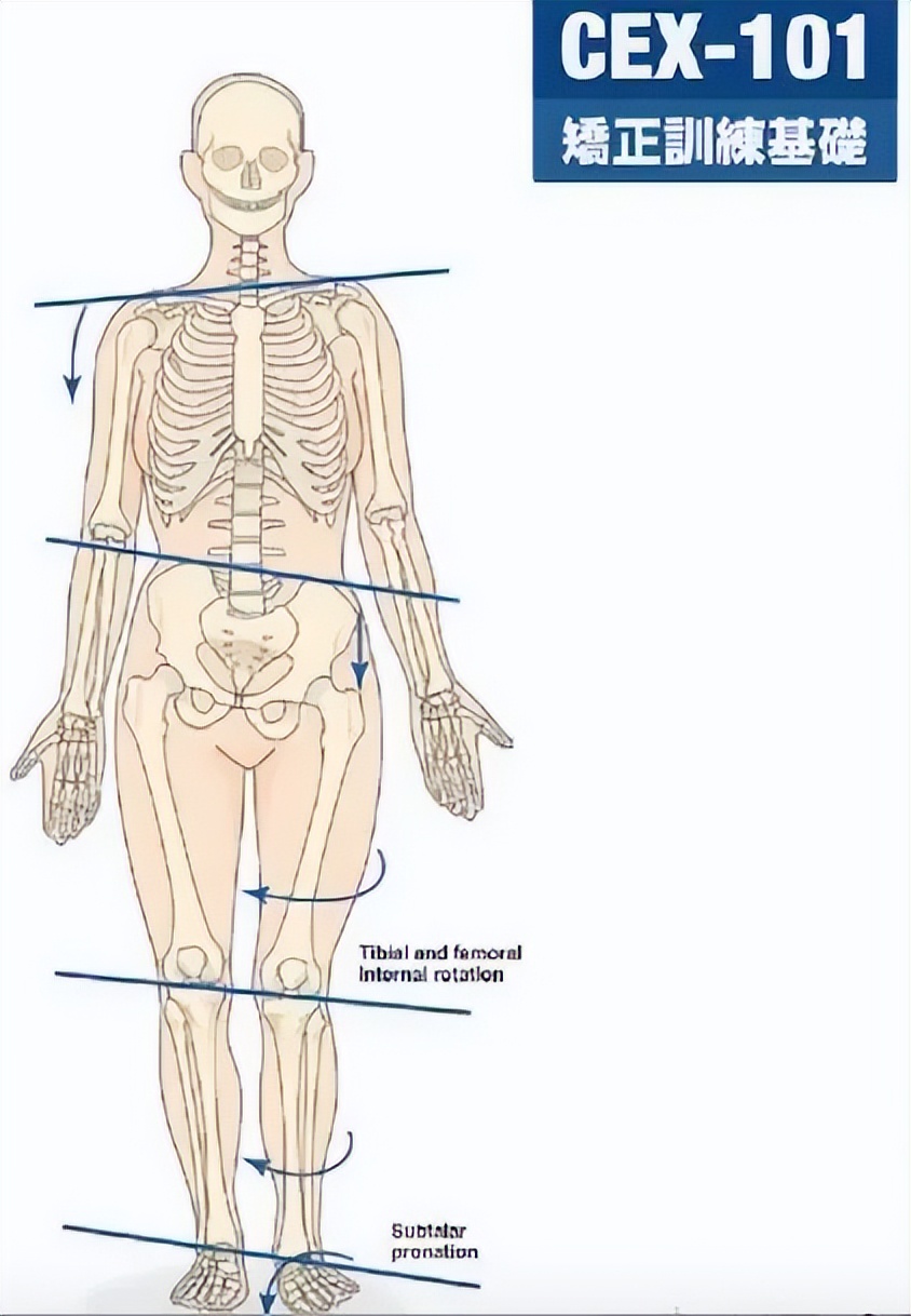 走路像鸭子是哪块肌肉的问题,走路像鸭子一样的是什么原因