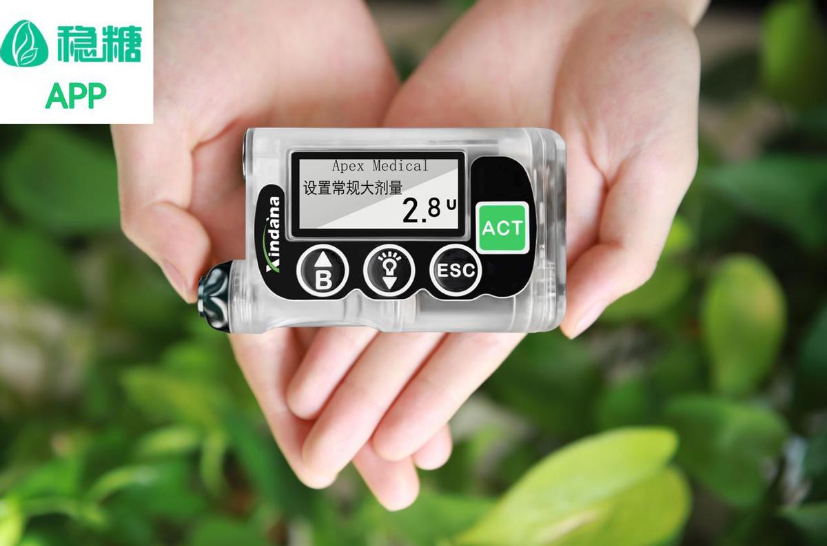 目前口碑最好的胰岛素泵,优泵胰岛素泵最新价格