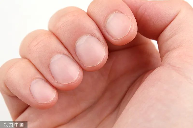 指甲出现凸起横纹当心三大疾病,指甲上有白色斑点和有倒刺