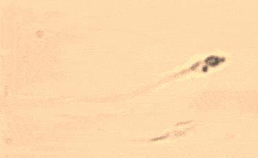 精子的运动能量,精子活动力半数呈直线运动