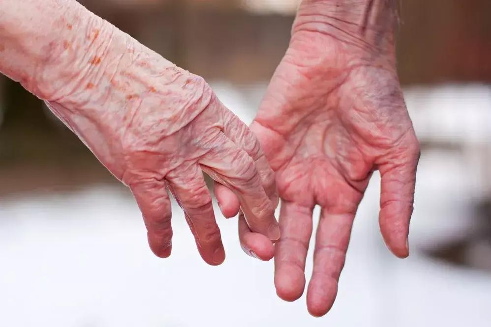 老年男艾滋的10个征兆,老年人艾滋病成为高发原因