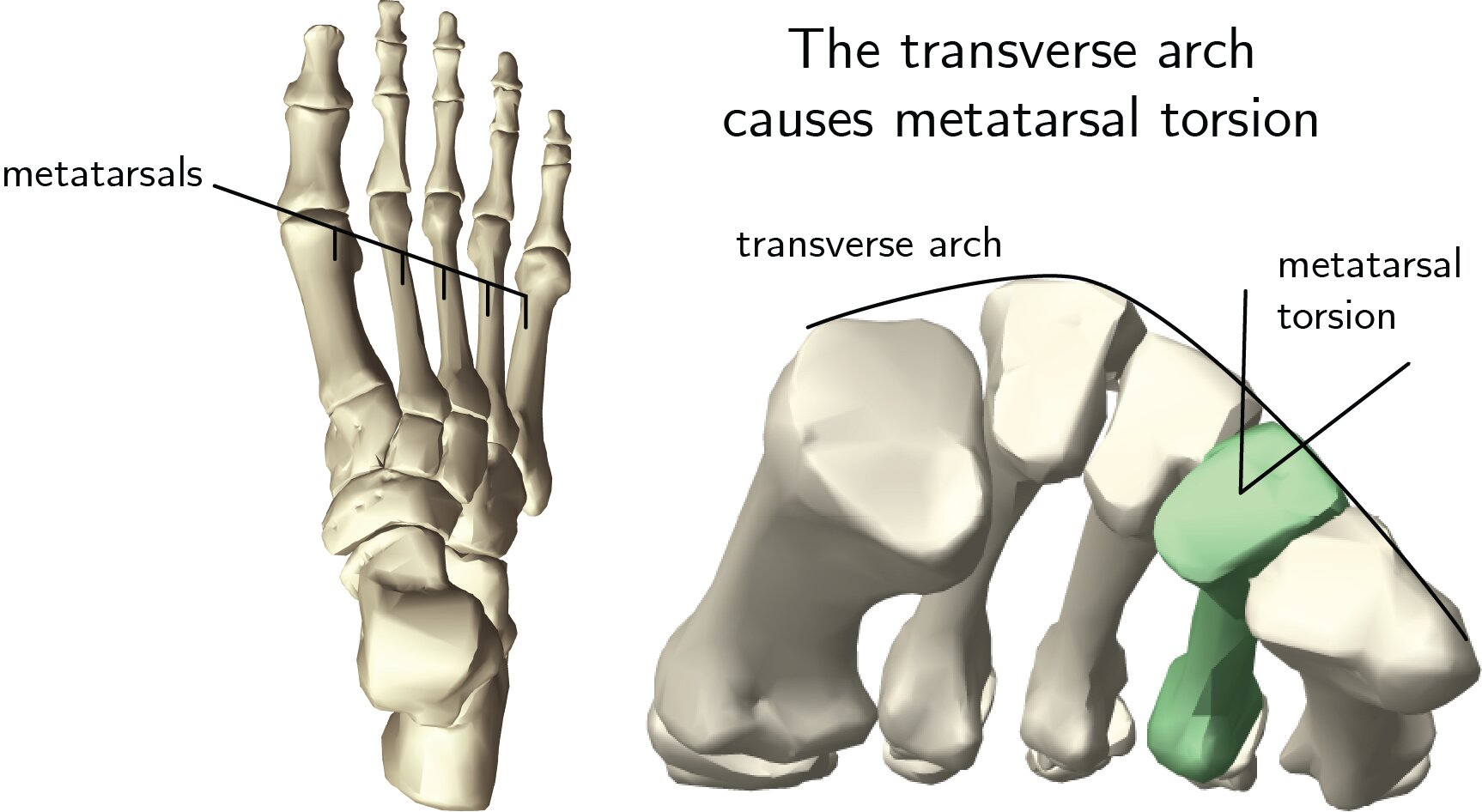大拇趾短怎么办？脚拇趾太短了可以手术吗？
