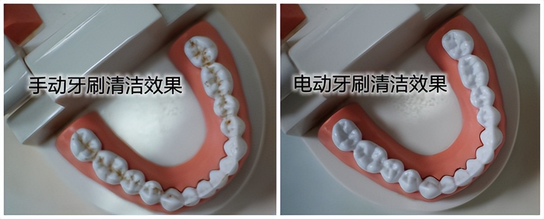 徕芬2023电动牙刷,儿童牙刷测评电动2023