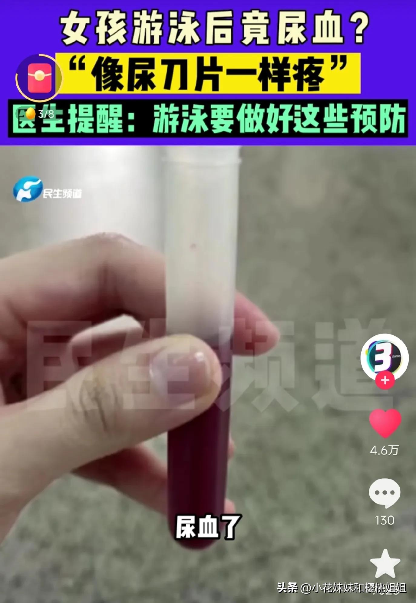 游泳尿路感染女生,游泳馆游泳会尿路感染吗