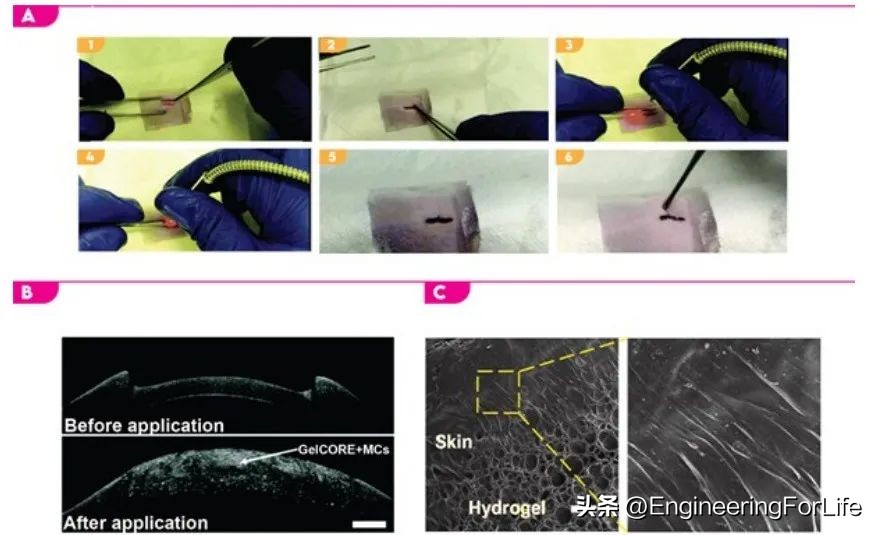 《AM》综述：对具有抗菌性能生物粘合剂的深度剖析